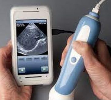 Portable Ultrasound device